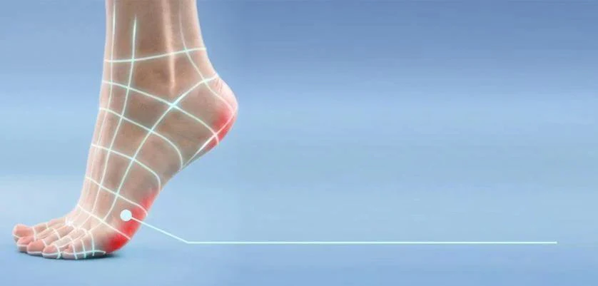 Hard Skin on Feet &amp; Cracked Heels