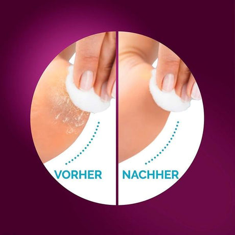 Scholl Site DE Care Scholl Velvet Smooth Pro Elektrischer Hornhautentferner